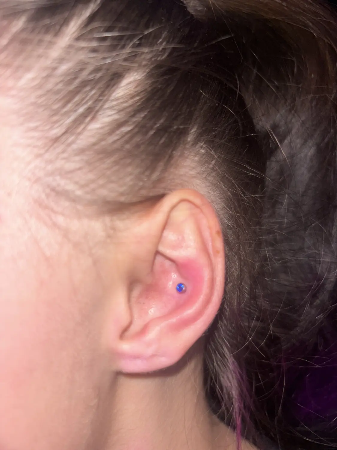 Percing von Stichstelle Tattoo